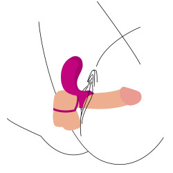 Xocoon Cockring vibrant Annel Stim 30mm